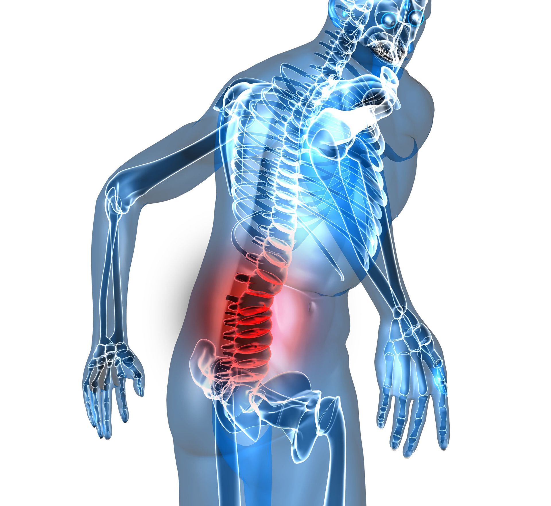 chronic low back pain, low back pain treatment, lumbago